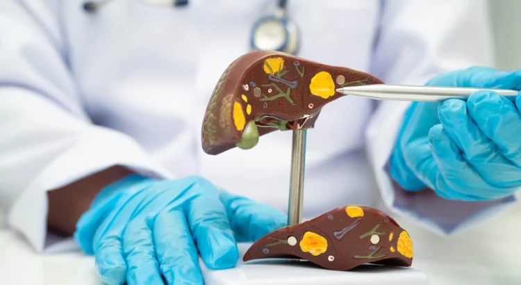 Deteksi Dini Hepatitis B dan C Lindungi Kesehatan Hati