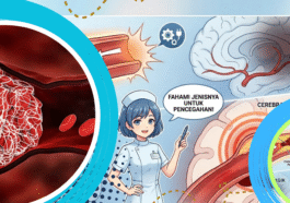 Gumpalan Darah Berbahaya, Kenali Risiko dan Pencegahannya