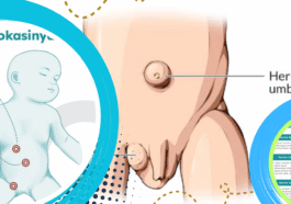 Hernia pada Anak Bisa Berbahaya, Kenali Gejalanya Sejak Dini