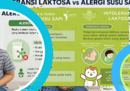 Beda Intoleransi Laktosa dan Alergi Susu pada Anak