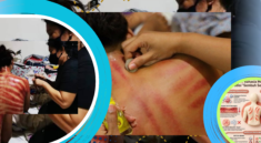 Kerokan Sambil Tidur, Ini Fakta dan Risikonya