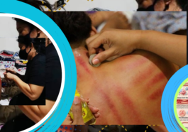 Kerokan Sambil Tidur, Ini Fakta dan Risikonya
