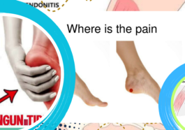 Nyeri Tumit Saat Bangun Tidur Kenali Plantar Fasciitis