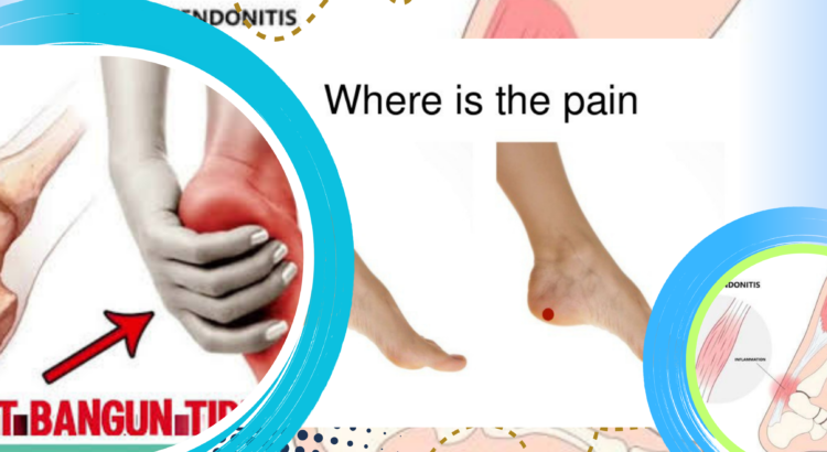 Nyeri Tumit Saat Bangun Tidur Kenali Plantar Fasciitis
