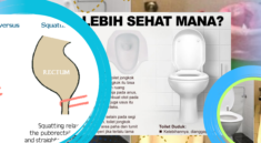 Toilet Jongkok vs Duduk, Mana Lebih Sehat untuk BAB