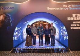 30 Tahun Siloam Kembangkan Layanan Neuroscience
