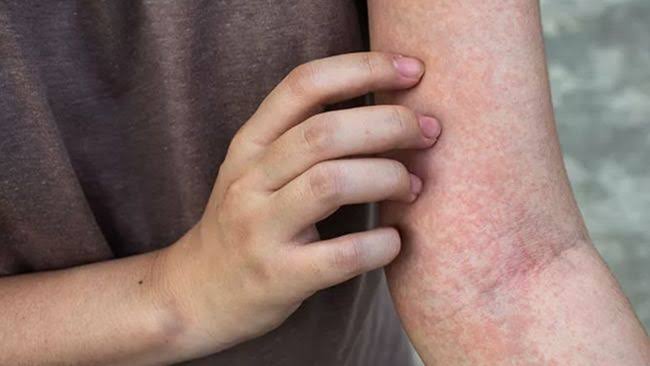 Kanker Langka Fakta, Risiko, dan Tantangan Diagnosis